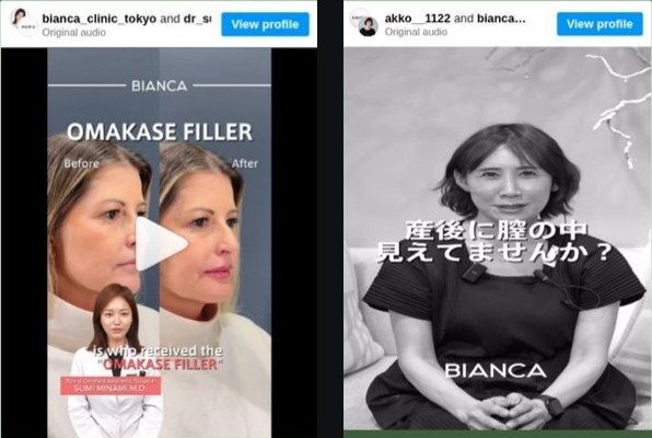 BIANCA CLINIC ショート動画制作